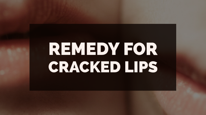 DIY for cracked lips